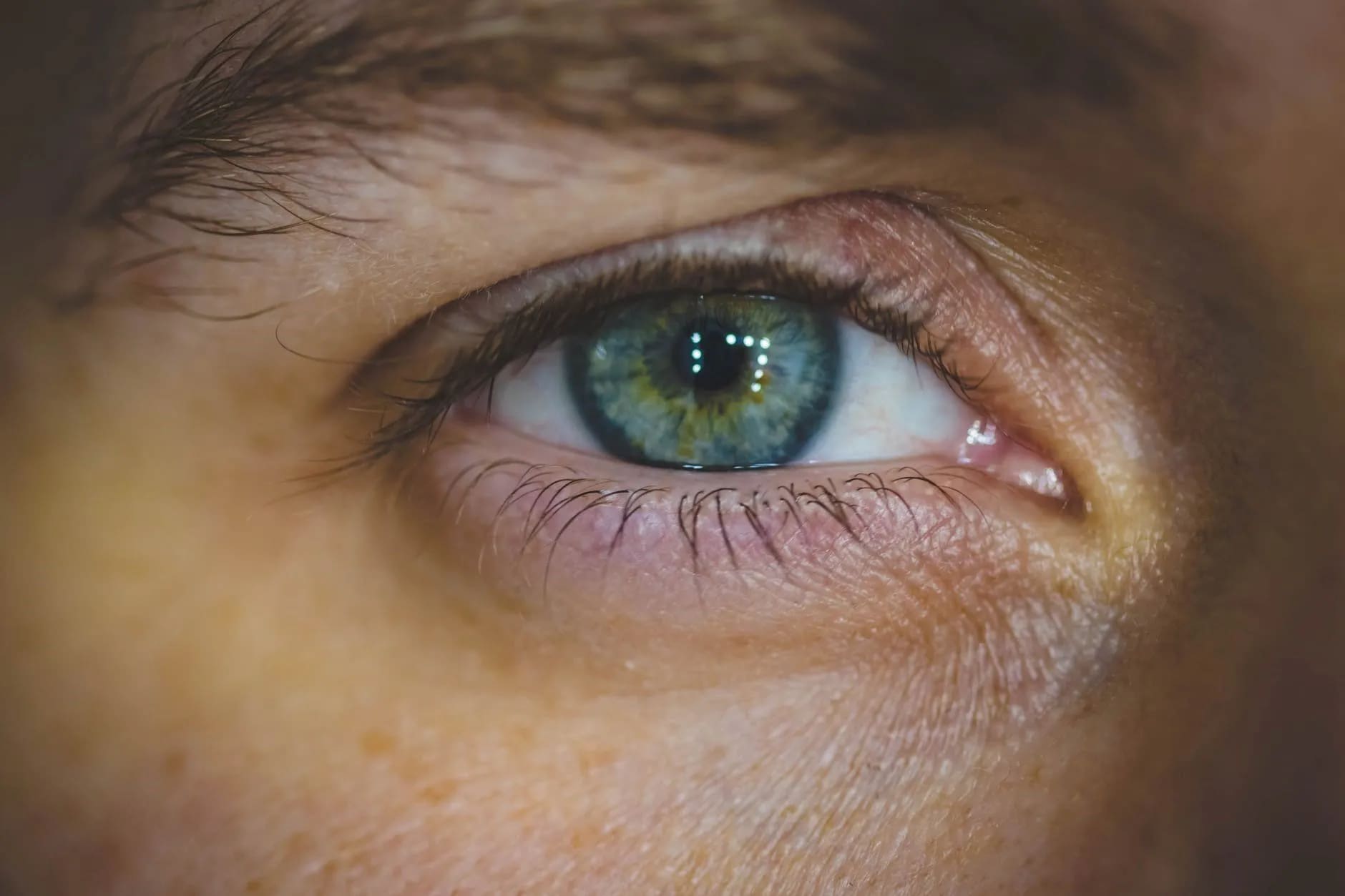Contact Lenses: Do's and Don'ts